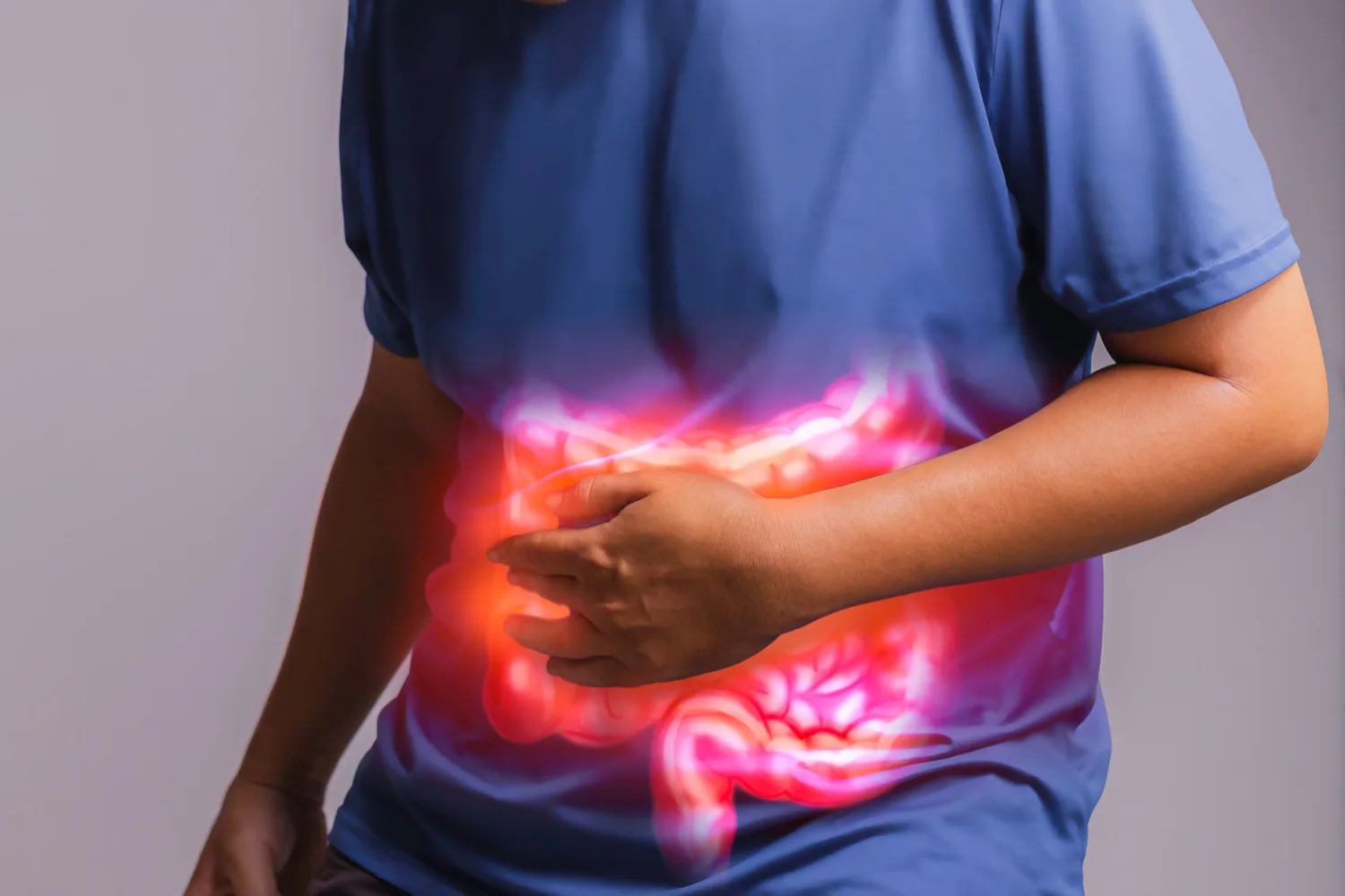 Divertículos y Enfermedad diverticular